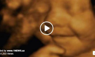 szia.sk - Elbűvölő videó: élet az anyaméhben